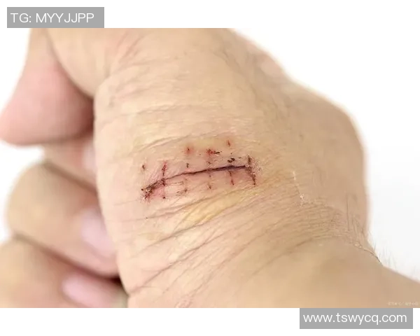 足球球星创口贴新潮流 个性化运动伤口护理引领时尚风潮